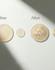 Before and after comparison of a pimple hydrocolloid patch extraction of pus on a neutral background with EcoFemini logo.
