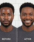 Before and after comparison of a man using oil control with a beard on a white tiled background