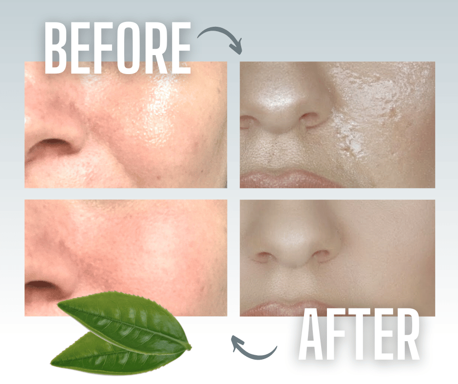 DISCREET & EASY TO USE - Small enough to fit discreetly in your handbag or pocket. Each pack includes 100 sheets.   GENTLE, YET ABSORBENT - With the added benefit of antioxidants and anti-inflammatory properties, our green tea-infused pure hemp & softwood pulp papers are soft and kind to sensitive skin. Perfect for acne-prone complexions.