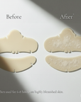 The Pimple Patch + 6 Nose & Chin Hydrocolloid Blemish Patches - Absorbs & Protects