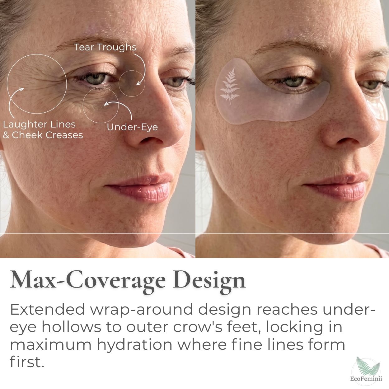 eye-patch-large-coverage-crows-feet-under-eye-tear-troughs-hollows