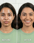 Before and after comparison of a woman with visible skin improvement on a white tiled wall background.
